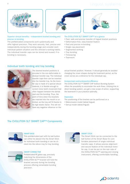 EVOLUTION SLT™ | JOY™ LINGUAL - Adenta