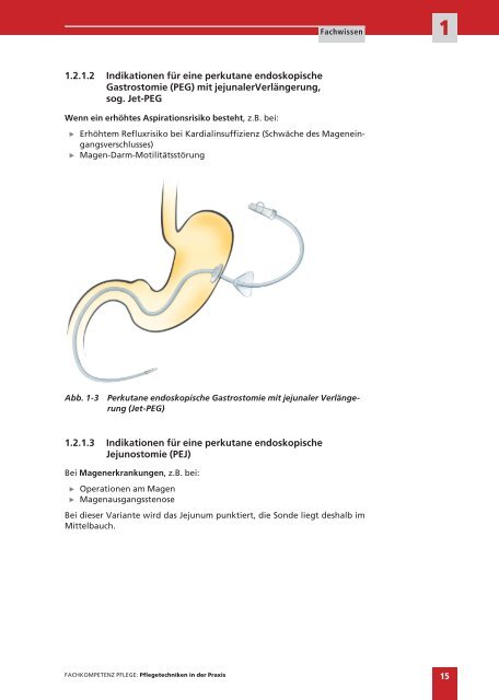 Kapitel Versorgung einer perkutanen endoskopischen Gastrostomie