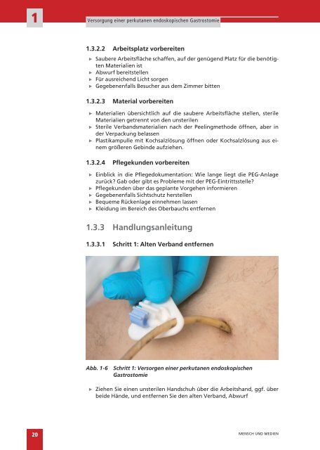 Kapitel Versorgung einer perkutanen endoskopischen Gastrostomie