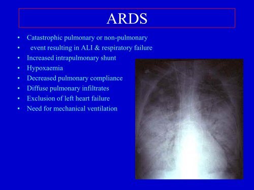 open lung approach concept of mechanical ventilation