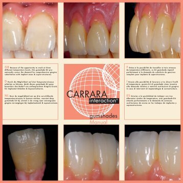 Carrara Interaction gumshades Kit - Elephant Dental