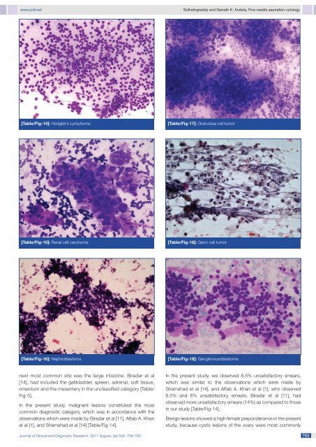 Fine Needle Aspiration Cytology of Intra-Abdominal Lesions - JCDR