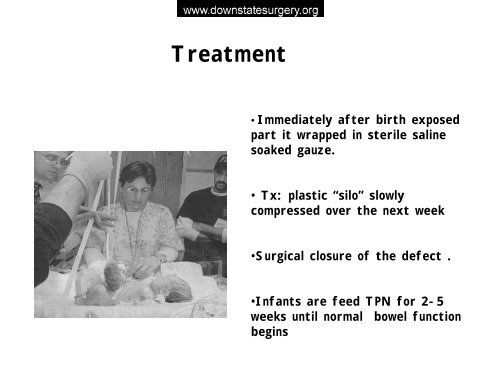 Abdominal Wall Defects - Department of Surgery at SUNY ...