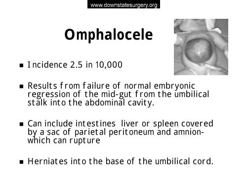 Abdominal Wall Defects - Department of Surgery at SUNY ...