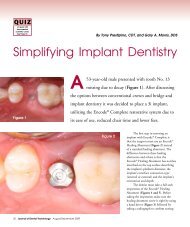 Simplifying Implant Dentistry - JDT Unbound