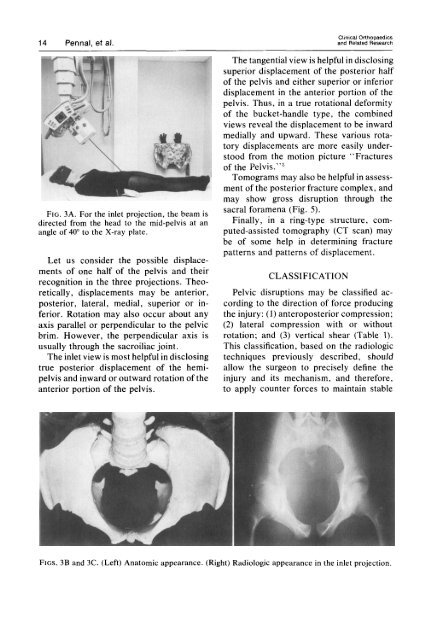 Pelvic Disruption: Assessment and Classification