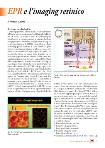 EPR e l'imaging retinico - Studio Oculistico dott. Amedeo Lucente