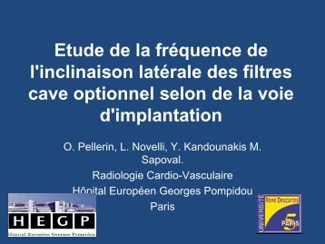 Etude de la frÃ©quence de l'inclinaison latÃ©rale des filtres cave ...