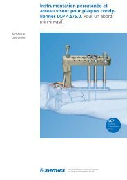 Plaque LCP condylienne 4.5-5.0 - Abord mini-invasif.pdf - Synthes