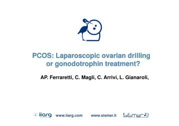 PCOS: Laparoscopic Laparoscopic ovarian drilling or ... - eshre