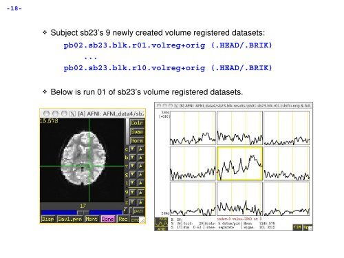 dset 1 1 1 stats.sb04.betas+tlrc