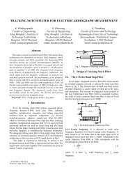 tracking notch filter for electrocardiograph measurement