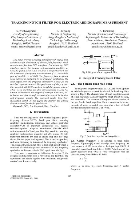 tracking notch filter for electrocardiograph measurement