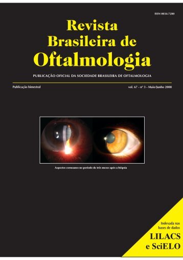 Mai-Jun - Sociedade Brasileira de Oftalmologia