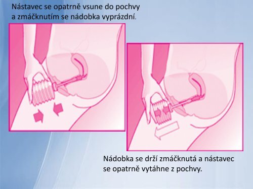 PodÃ¡vÃ¡nÃ­ lÃ©kÅ¯ v gynekologii