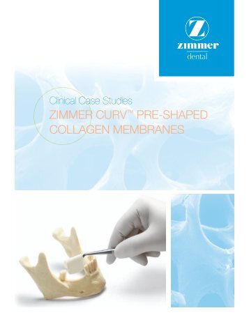 zimmer curvÃ¢Â„Â¢ pre-shaped collagen membranes - Zimmer Dental