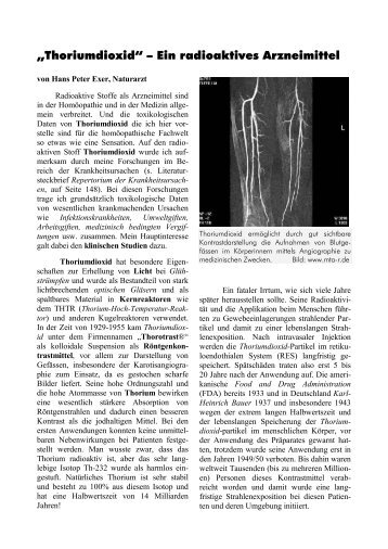 „Thoriumdioxid“ – Ein radioaktives Arzneimittel - Fit mit System!