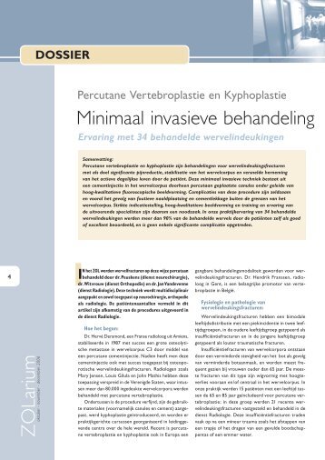 Percutane vertebroplastie voor wervelindeukingen, metastasen of ...