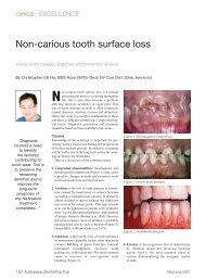 Non-carious tooth surface loss - Institute for Dental Implants