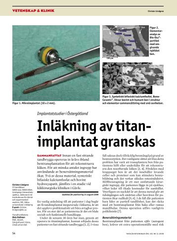 Inläkning av titanimplantat granskas - Tandläkartidningen