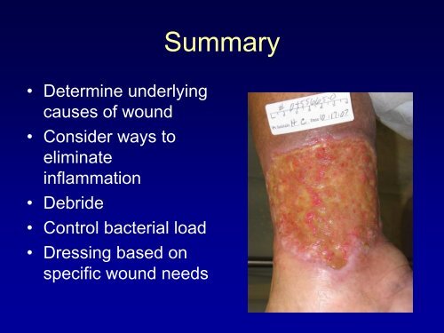 Topical Management of arterial and venous ulcers - VascularWeb