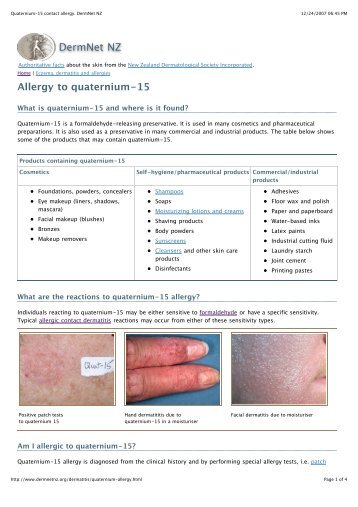 Quaternium-15 contact allergy. DermNet NZ