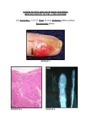 lesion en dedo anular de mano izquierda - PIEL-L Latinoamericana