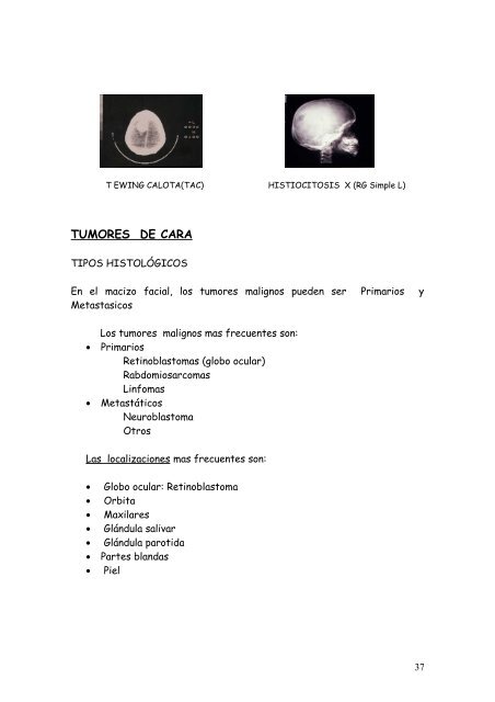 Signos y SÃ­ntomas de Alarma en el CÃ¡ncer Infantil