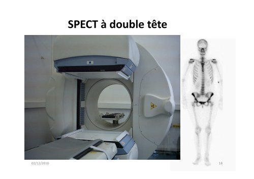 Bases physiques de l'imagerie en Médecine Nucléaire (MN)