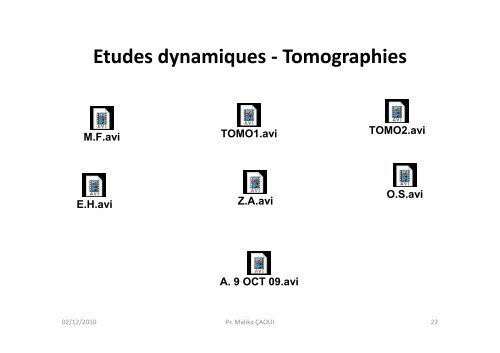 Bases physiques de l'imagerie en Médecine Nucléaire (MN)