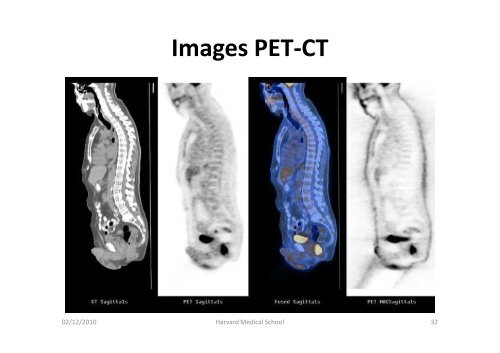 Bases physiques de l'imagerie en Médecine Nucléaire (MN)