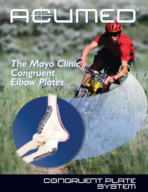 The Mayo Clinic Congruent Elbow Plates - ShoulderDoc.co.uk