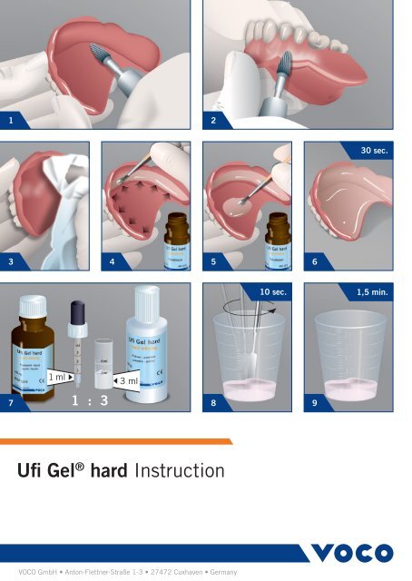 Ufi GelÂ® hard Instruction - Voco