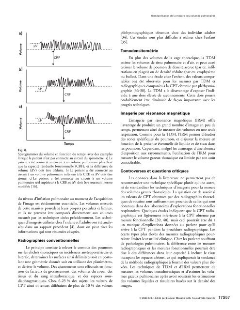 Explorations fonctionnelles respiratoires - SPLF