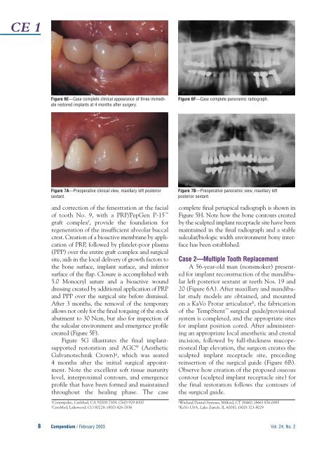 Immediate Implant Placement and Provisionalization - Zimmer Dental