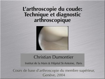 L'arthroscopie du coude: Technique et diagnostic ... - ClubOrtho.fr