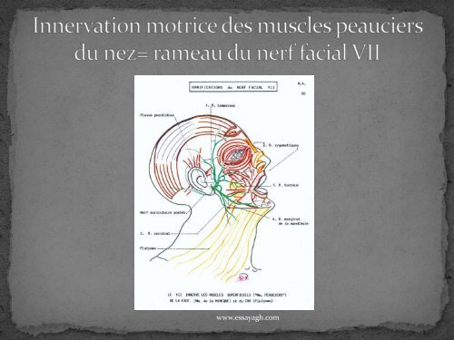 PROFILOPLASTIE NASALE A L'ACIDE HYALURONIQUE