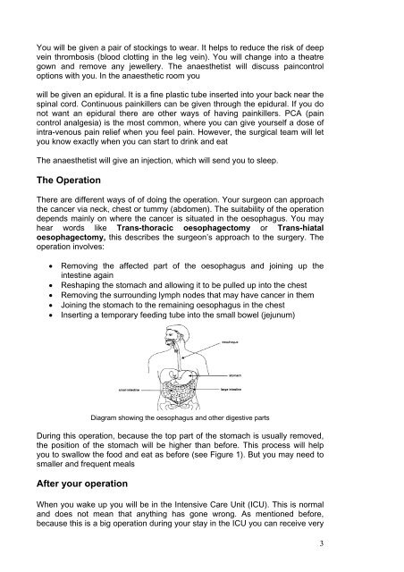 Oesophagectomy leaflet - Homerton University Hospital