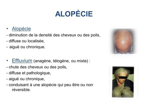 alopÃ©cie