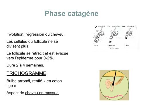 alopÃ©cie