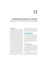 VentilaciÃ³n mecÃ¡nica no invasiva - Neumosur