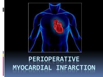 Perioperative Myocardial Infarction