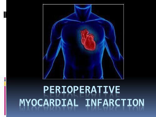 Perioperative Myocardial Infarction