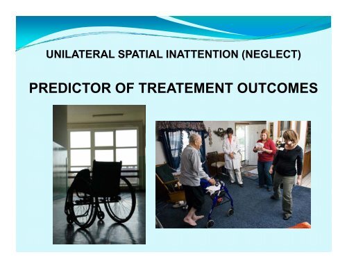 UNILATERAL SPATIAL INATTENTION (NEGLECT)