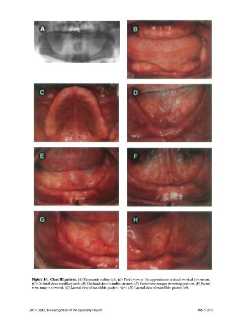 PROSTHODONTICS - American College of Prosthodontists