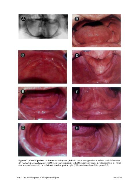 PROSTHODONTICS - American College of Prosthodontists