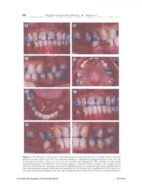 PROSTHODONTICS - American College of Prosthodontists