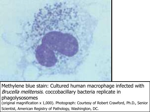 Microbial Diseases of the Cardiovascular and Lymphatic Systems