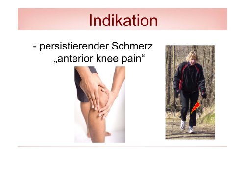 Der sekundÃ¤re Patellaersatz - Vinzenz Gruppe