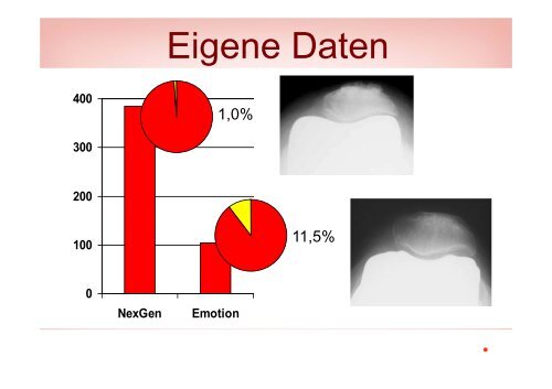 Der sekundÃ¤re Patellaersatz - Vinzenz Gruppe